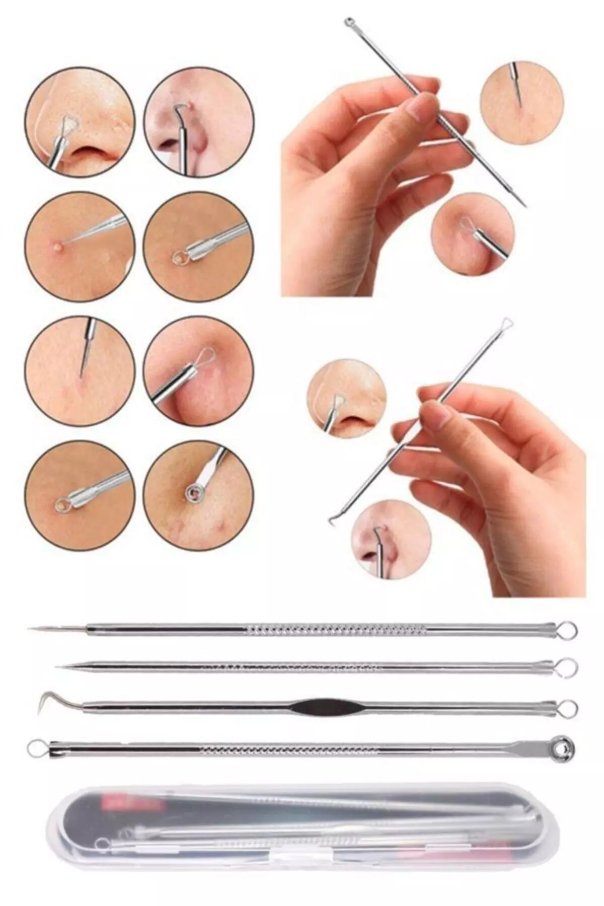 4-in-1 Blackhead Remover Comedone
